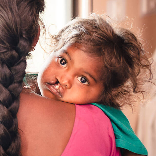 Cleft Operation, eine neues Leben beginnt
